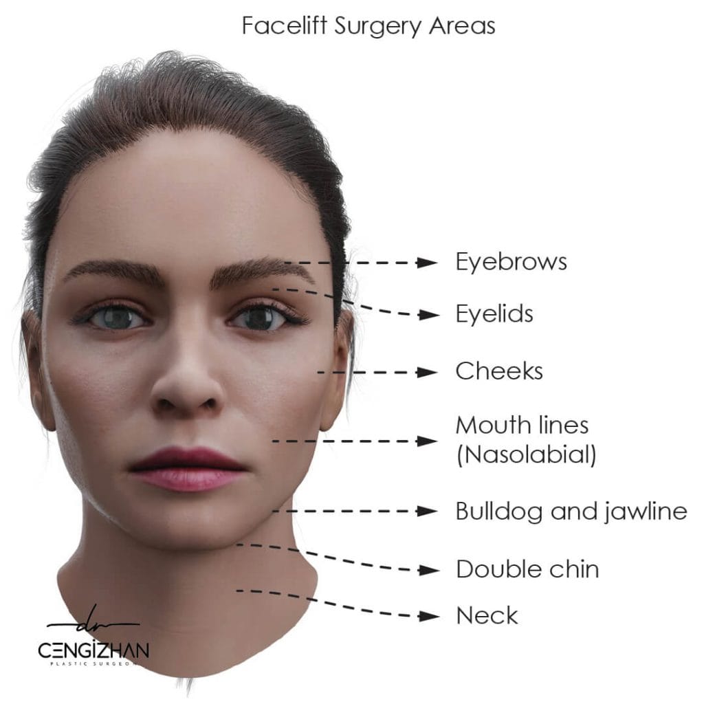 Facelift Surgery Areas