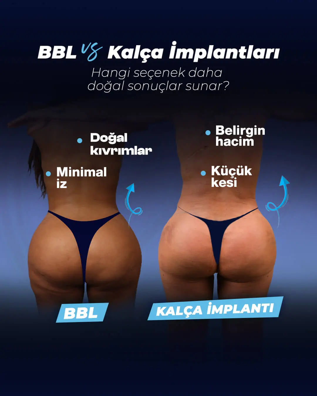 Kalça İmplantı mı, BBL mi? Rehberi - Dr. Cengizhan Ekizceli