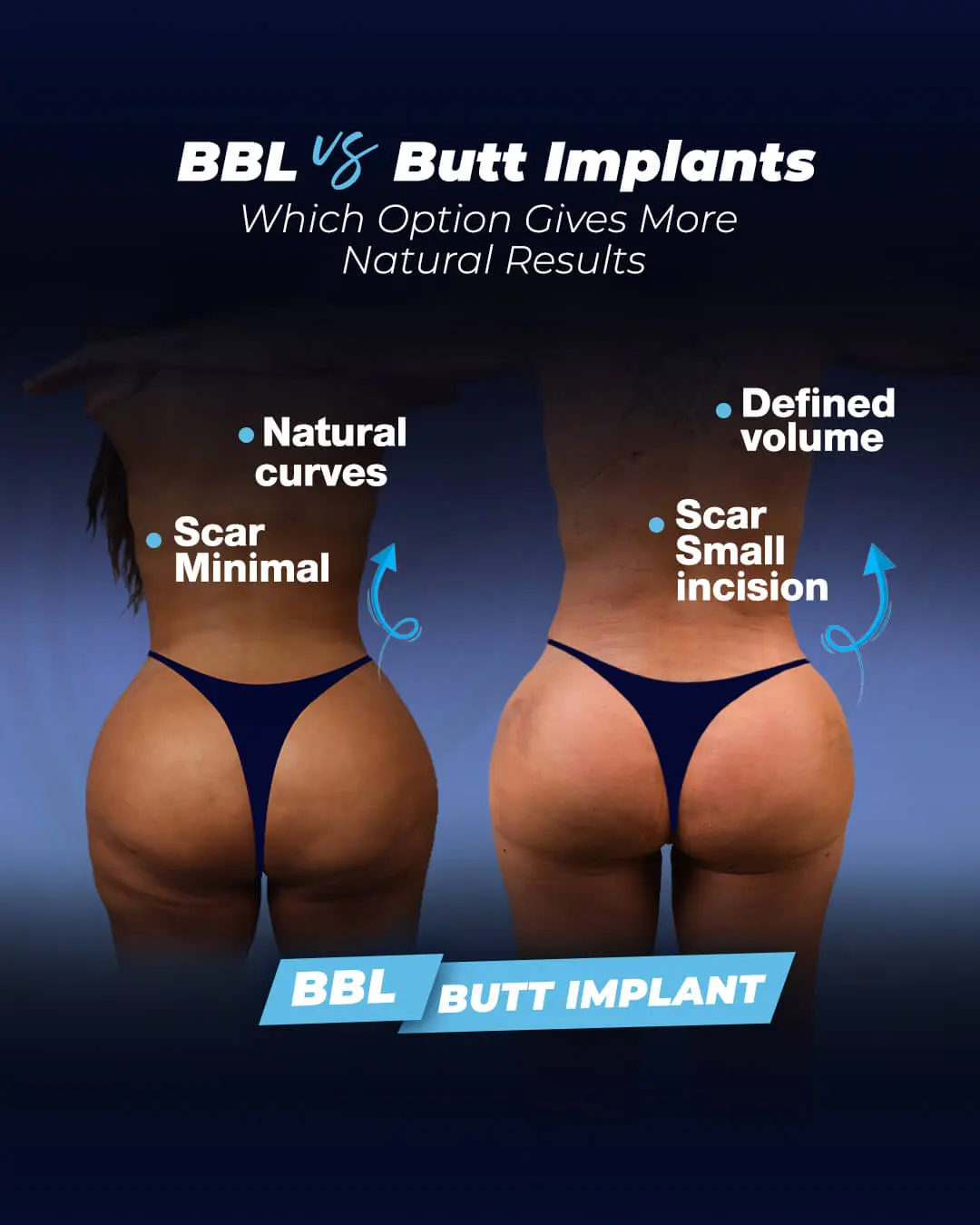 BBL-vs-Butt-Implants A Guide by Dr. Cengizhan Ekizceli