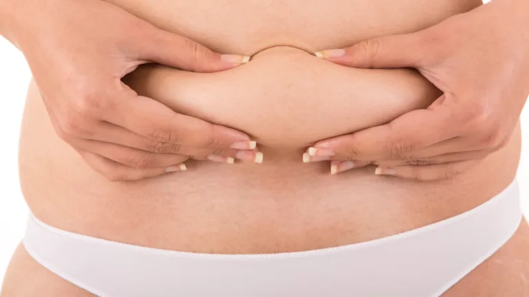 Loose skin after a tummy tuck (age and genetics)