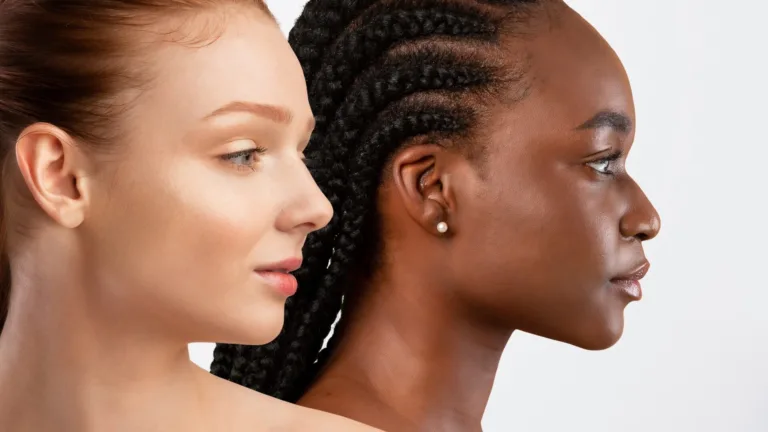 Ethnic rhinoplasty in Turkey