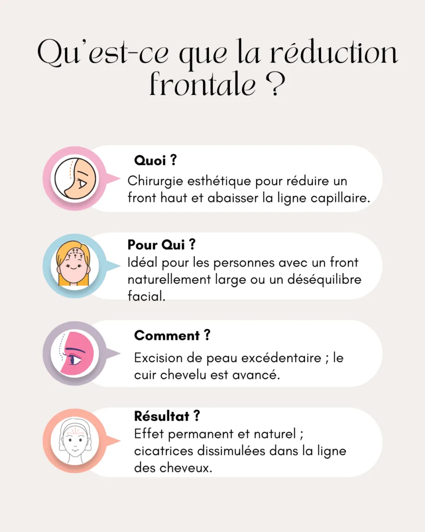 Qu’est-ce que la réduction frontale