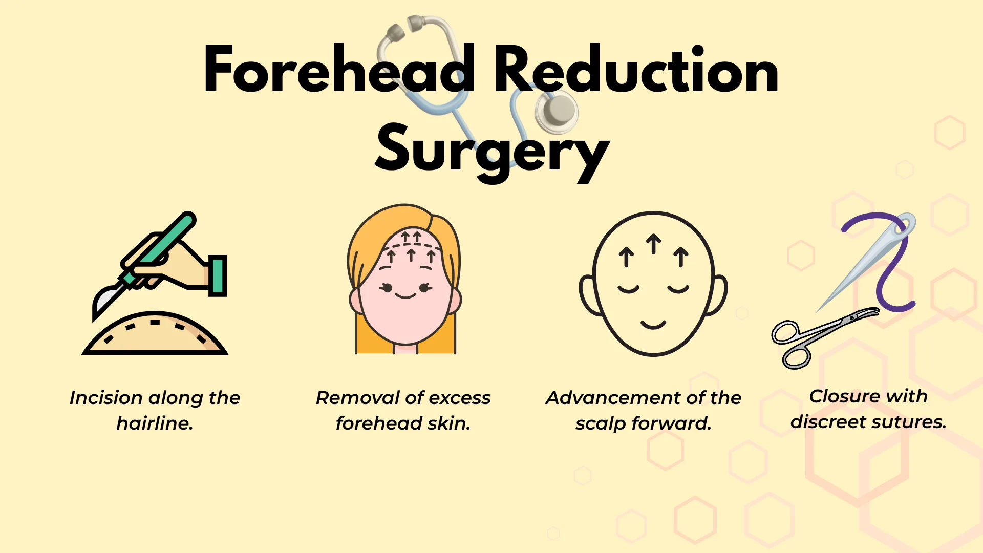 Infographic: Forehead Reduction Surgery