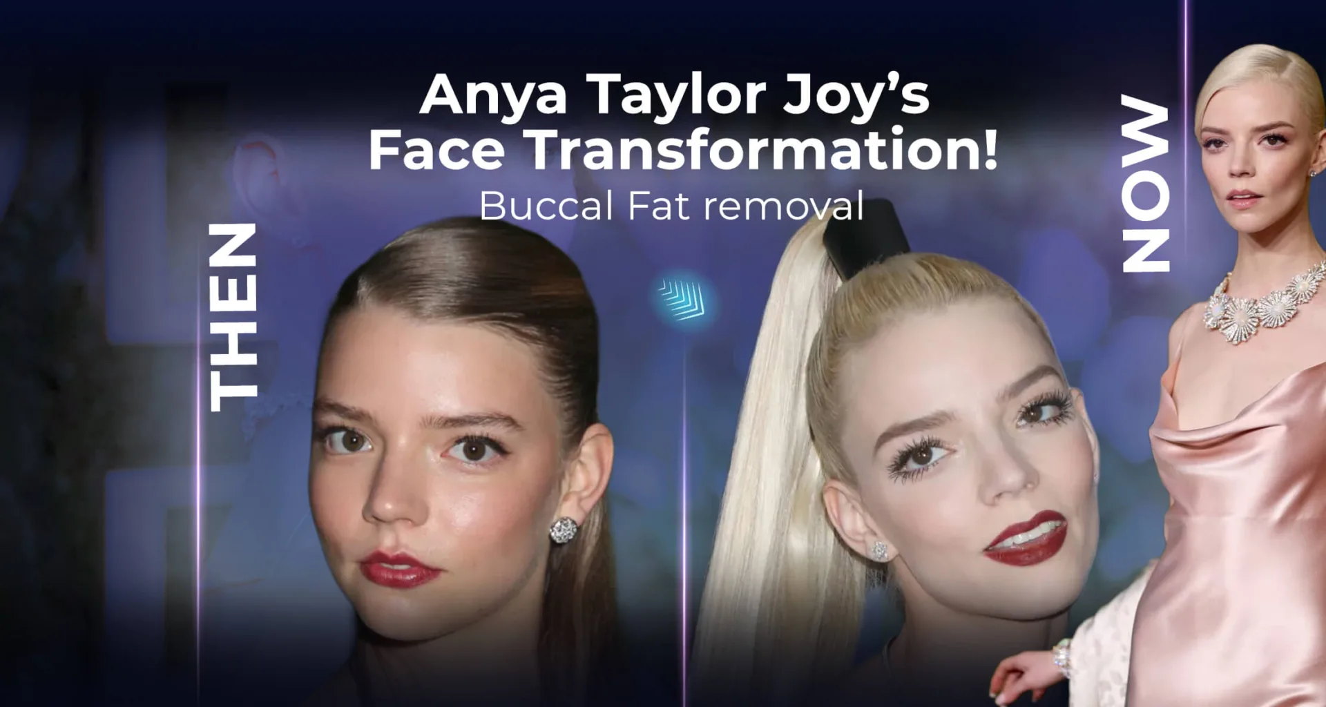 Le nouveau look d'Anya Taylor-Joy