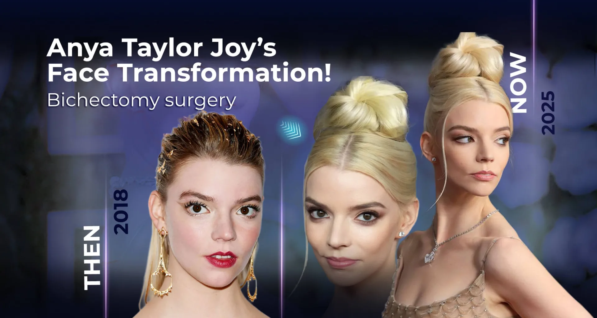 La transformation d'Anya Taylor-Joy