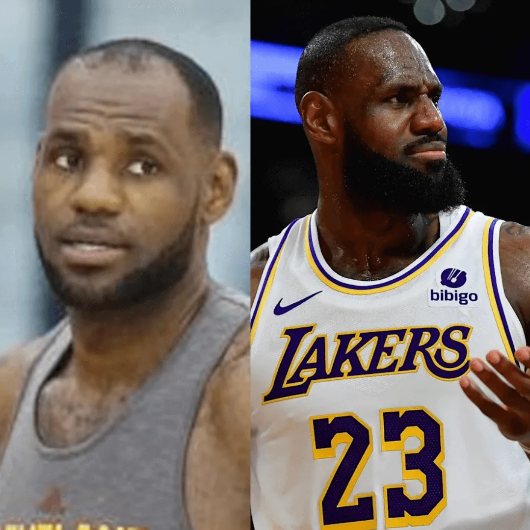 Lebron James Changing Hairline