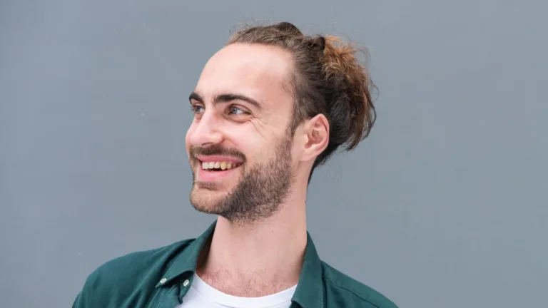 Natural vs. Surgical Male Celebs With Big Foreheads
