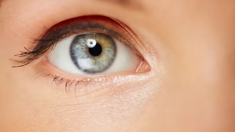 Upper Blepharoplasty