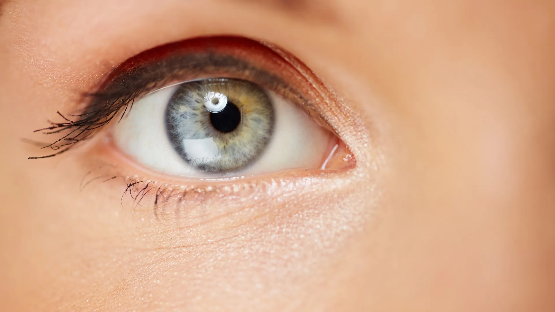 Upper Blepharoplasty