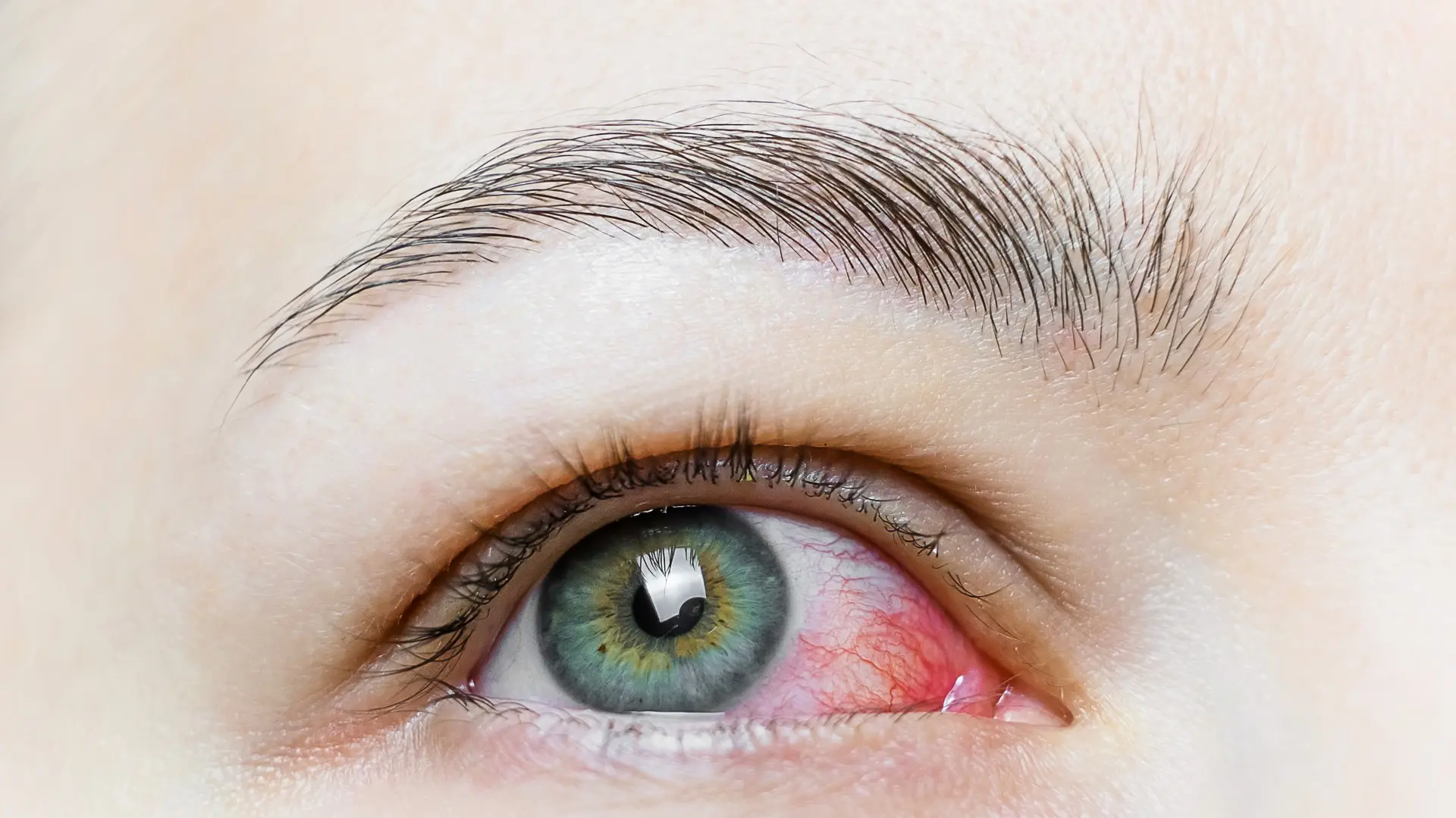 Upper Eyelid Surgery vs. Botox Which is Better for Hooded Eyes