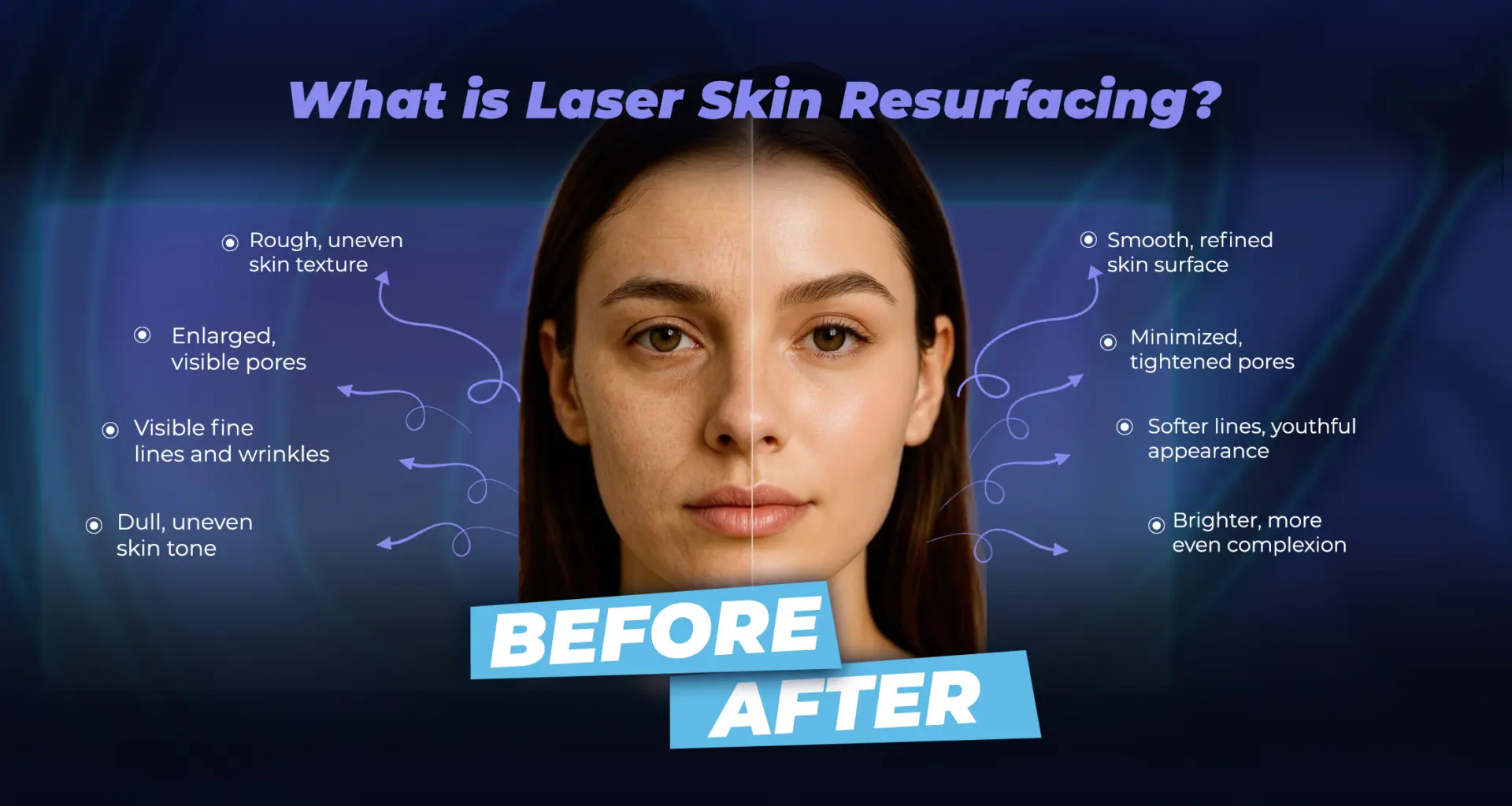 نتائج عملية تجديد سطح البشرة بالليزر قبل وبعد