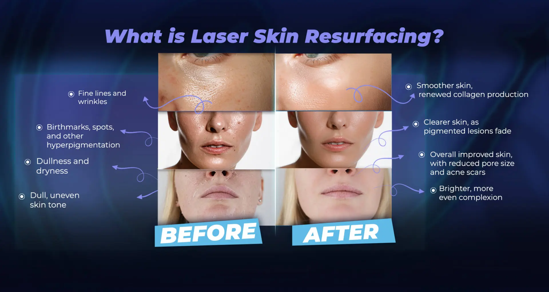 ما هو تجديد سطح الجلد بالليزر؟