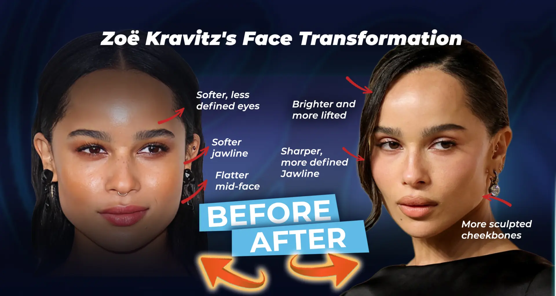 Zoë Kravitz's Face Analysis