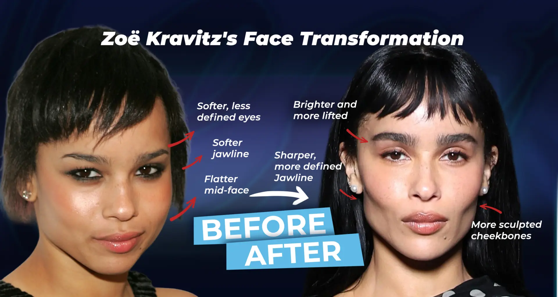 Zoë Kravitz's Face Analysis (before and after)