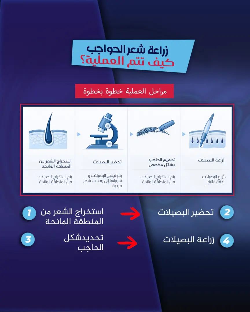 دليل زراعة شعر الحواجب - كيف تتم العملية؟ بقلم الدكتور جنكيزهان إيكيزجيلي