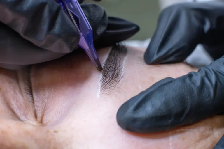 Brow Transplant vs. Microblading Which Path is Right for You