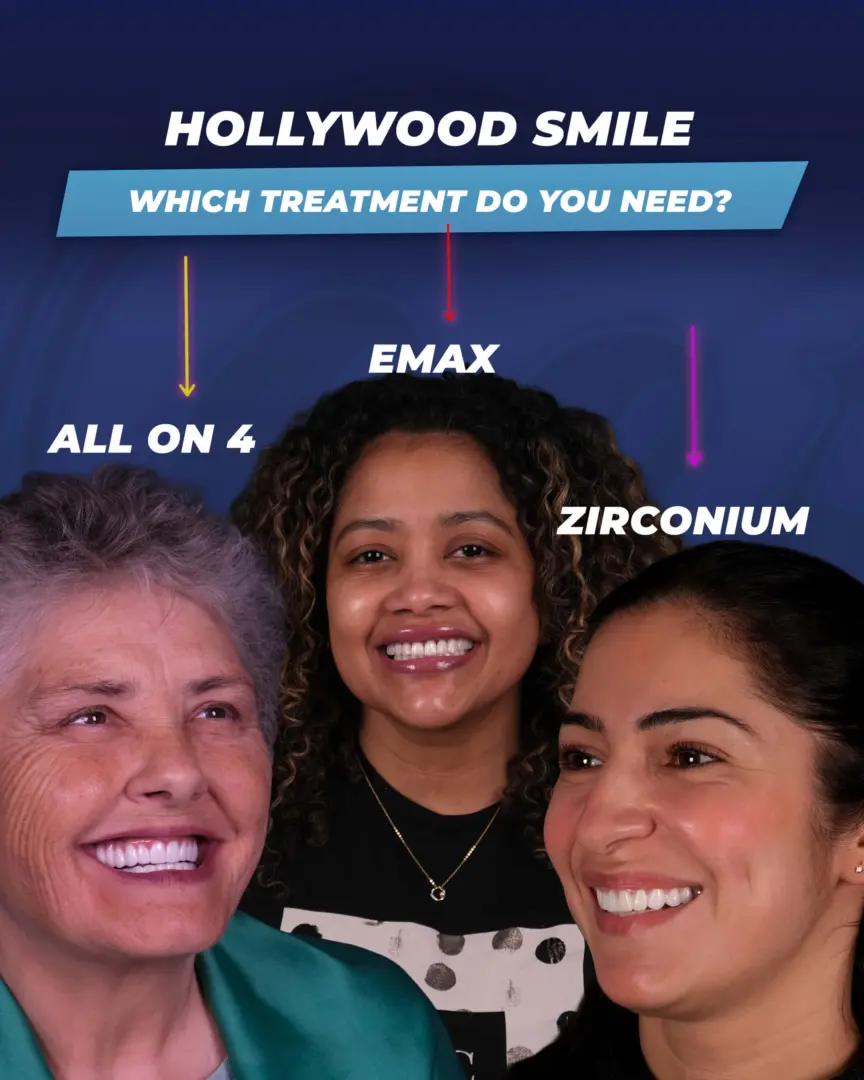 Hollywood Smile by Dr. Cengizhan (the Estherian Clinic)