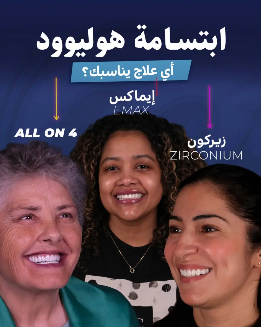 ابتسامة هوليوود من تصميم الدكتور جنكيزهان (عيادة إستيريان)