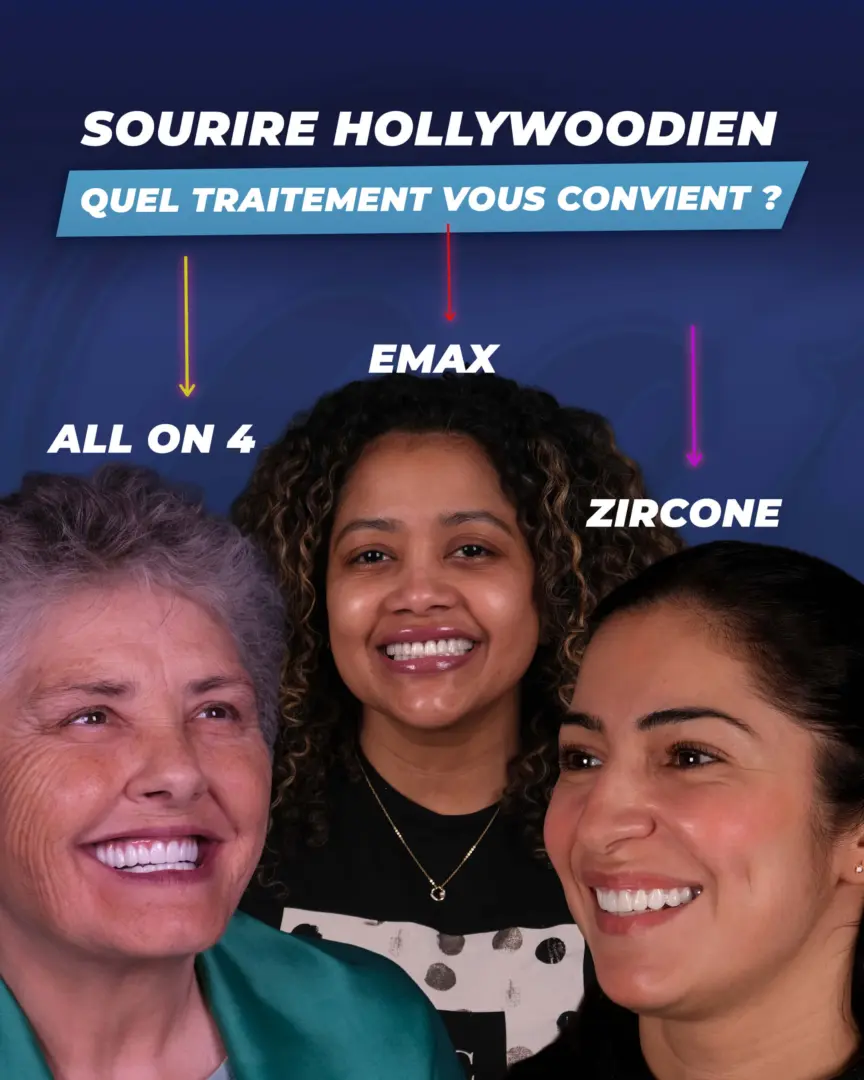 Sourire hollywoodien par le Dr Cengizhan (clinique Estherian)