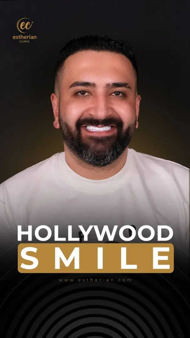 Hollywood Smile Transformation Real Patient Results by the Estherian Clinic