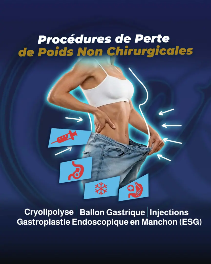 Guide des procédures de perte de poids non chirurgicales par le Dr Cengizhan Ekizceli