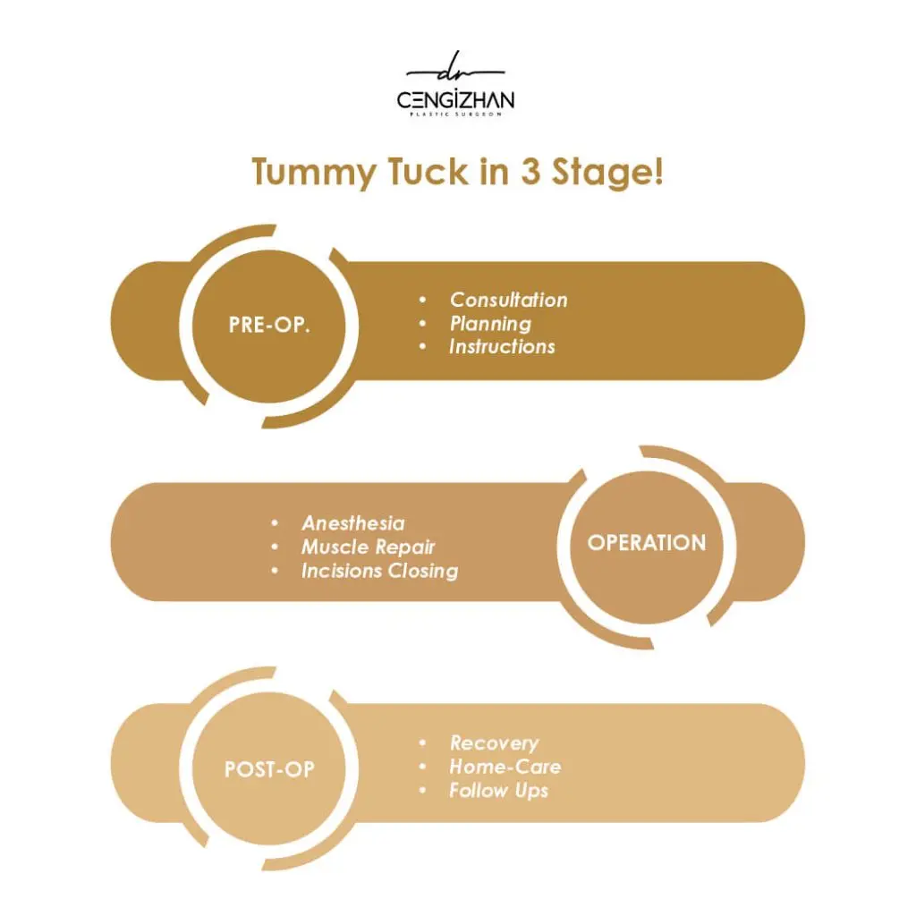  Infografik zur Bauchdeckenstraffung (Tummy Tuck) in der Türkei in drei Phasen: Pre-Op mit Beratung, Planung und Anweisungen; Operation mit Anästhesie, Muskelstraffung und Wundverschluss; Post-Op mit Genesung, häuslicher Pflege und Nachsorgeterminen.