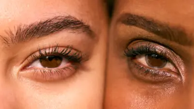 Cat Eye Surgery
